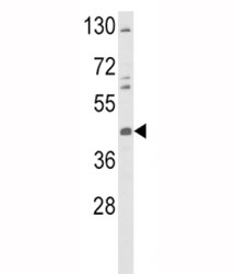 Western blot analysis of TAT antibody and K562 lysate.