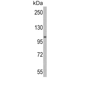 Western blot testing of human HL60 cell lysate with Ubiquitin-like modifier-activating enzyme 1 antibody. Expected molecular weight: ~118/114 kDa (isoforms a/b).
