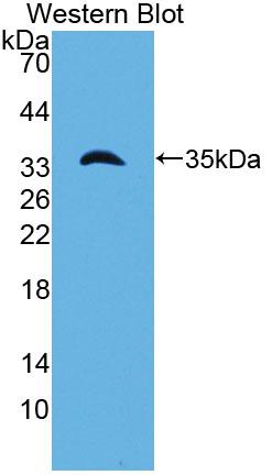 Western Blot; Sample: Recombinant protein.