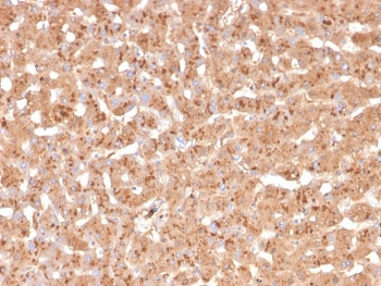 IHC staining of FFPE human liver with Transthyretin antibody. HIER: boil tissue sections in pH 9 10mM Tris with 1mM EDTA for 20 min and allow to cool before testing.