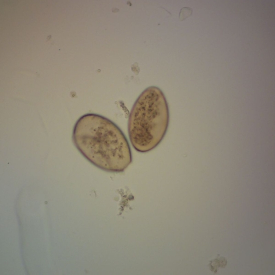 Fasciola hepatica (Sheep Liver Fluke) Eggs, w.m. Microscope Slide
