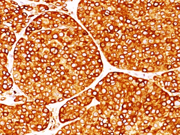 Anti-Tyrosinase Antibody [T311] - BSA and Azide free