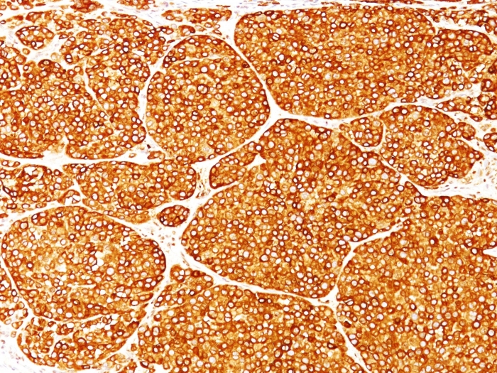 Anti-Tyrosinase Antibody [T311] - BSA and Azide free