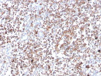 IHC staining of FFPE human tonsil with PRKCA antibody (clone 133). HIER: boil tissue sections in pH 9 10mM Tris with 1mM EDTA for 20 min and allow to cool before testing.