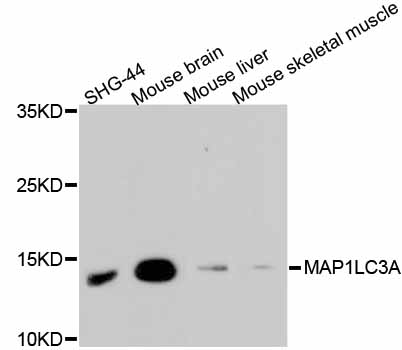 Anti-MAP1LC3A Antibody [Assigned #A11428]