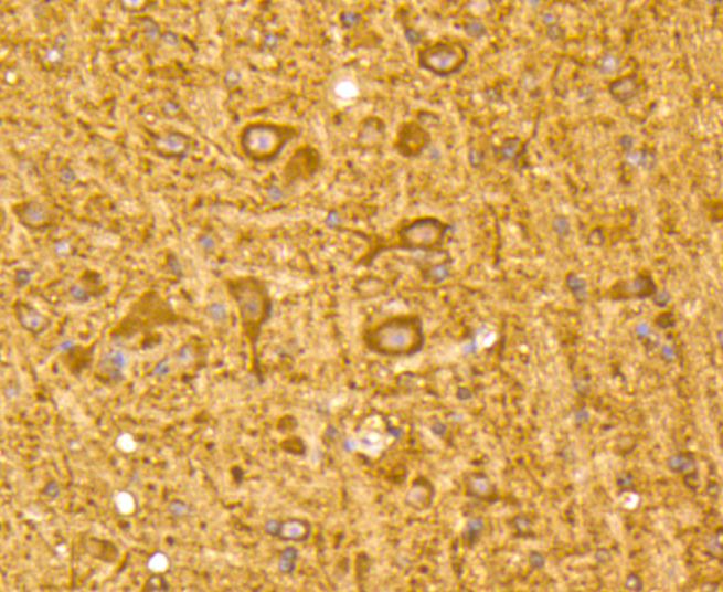 Anti-MAP1LC3A Antibody [Assigned #A11428]