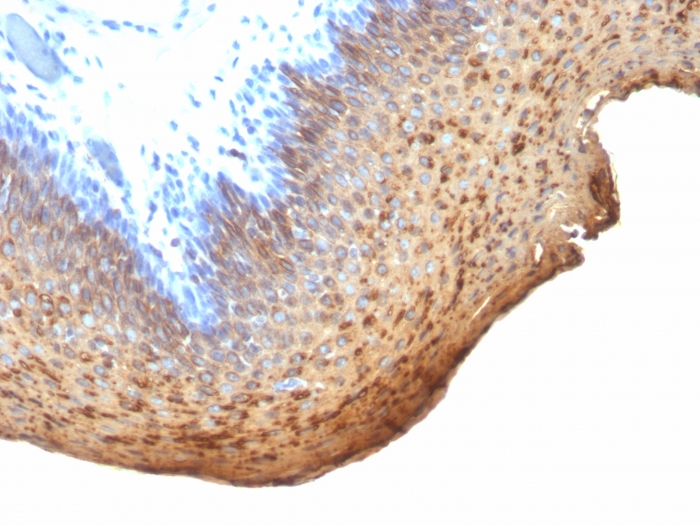 Anti-Cytokeratin 10 + 13 Antibody [DE-K13]