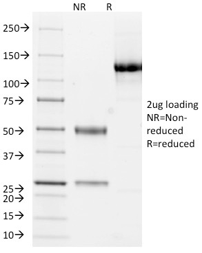 Anti-Cytokeratin 10 + 13 Antibody [DE-K13]