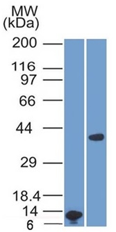 Anti-Arginase 1 Antibody [ARG1/1125]