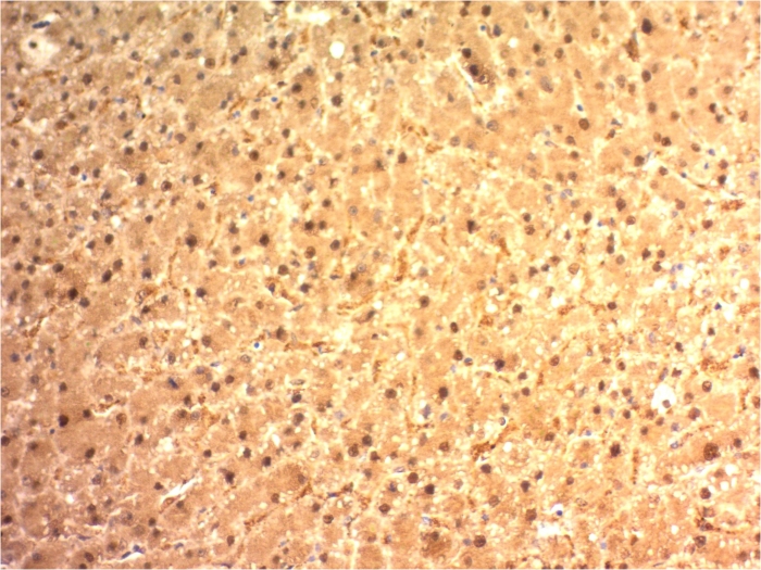 Anti-Arginase 1 Antibody [ARG1/1125]