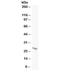 Western blot testing of A431 lysate with BAK1 antibody at 0.5ug/ml. Predicted molecular weight: ~23kDa.