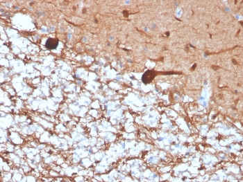 IHC staining of FFPE human cerebellum with recombinant PGP9.5 antibody (clone rUCHL1/4557). HIER: boil tissue sections in pH 9 10mM Tris with 1mM EDTA for 20 min and allow to cool before testing.