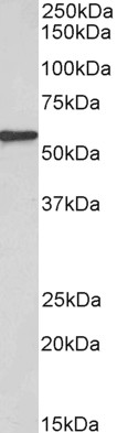 Anti-EPHX2 Antibody