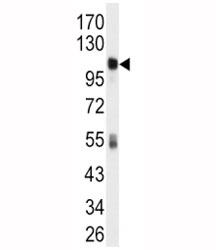 Western blot analysis of ALDH1L1 antibody and mouse liver tissue lysate.
