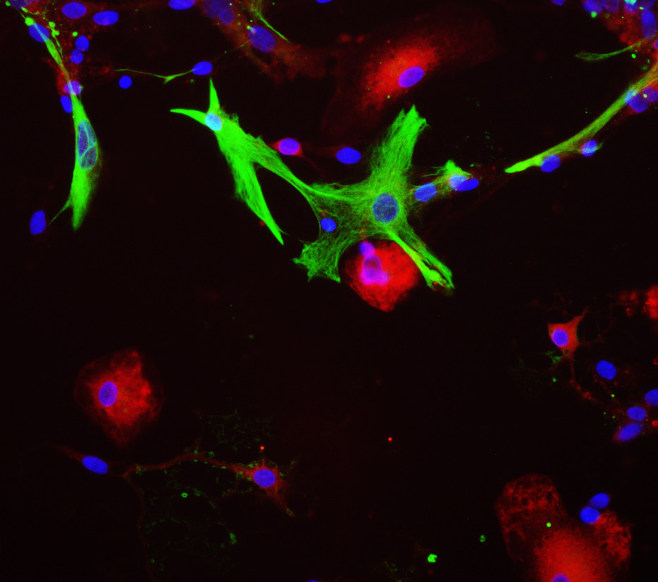 Anti-Aldolase A + Aldolase B + Aldolase C Antibody [E9]