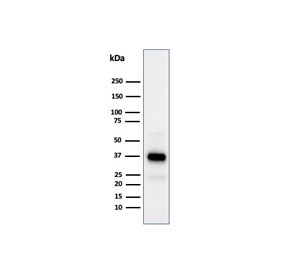 Western blot analysis of human testis tissue lysate using Apolipoprotein J antibody (clone CLU/4731). Predicted molecular weight: 75-80 kDa (heterodimer precursor), 36-39 kDa (alpha subunit), 34-36 kDa (beta subunit).