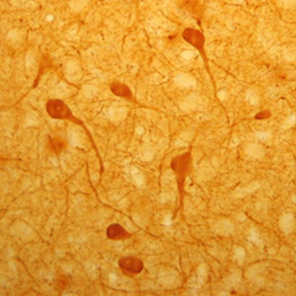 Calbindin D-28 Antibody