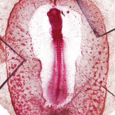 Chick 33-Hour Embryo Slide, w.m.