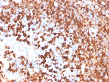 IHC staining of FFPE human tonsil with recombinant CD79a antibody (clone IGA/3939R). HIER: boil tissue sections in pH 9 10mM Tris with 1mM EDTA for 20 min and allow to cool before testing.