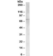 Western blot testing of human placenta lysate with ChAT antibody at 0.03ug/ml. Predicted molecular weight ~73kDa.