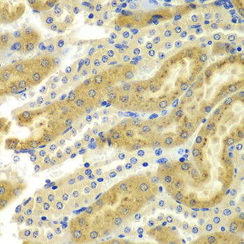 Anti-PAK2 Antibody