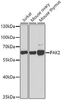 Anti-PAK2 Antibody