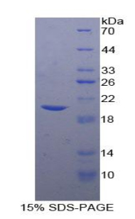 Figure. SDS-PAGE