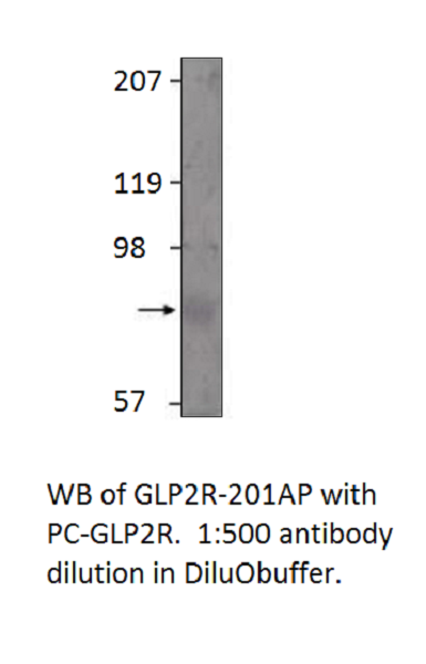 Anti-GLP2R Antibody