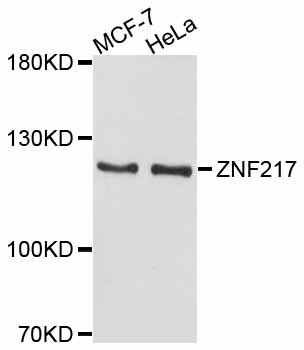 Anti-ZNF217 Antibody