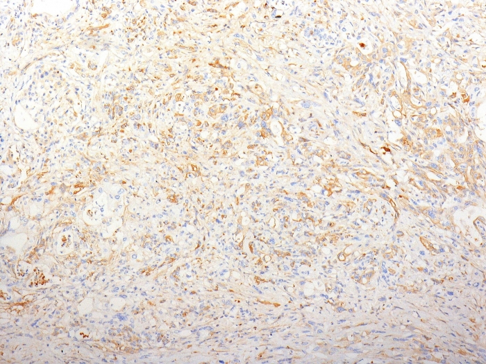 Anti-Fibronectin Antibody [TV-1] - BSA and Azide free