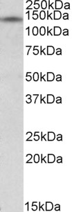 Anti-NRIP1 Antibody