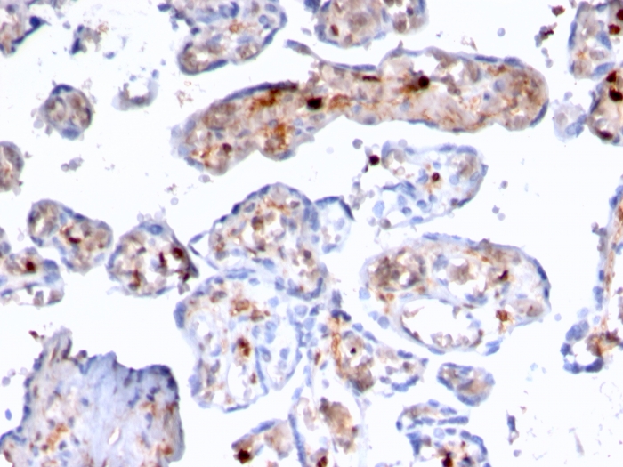 Anti-S100A4 Antibody [rS100A4/1481]