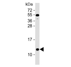 Western blot testing of human heart lysate with NDUFA2 antibody at 1:2000. Predicted molecular weight ~11 kDa.