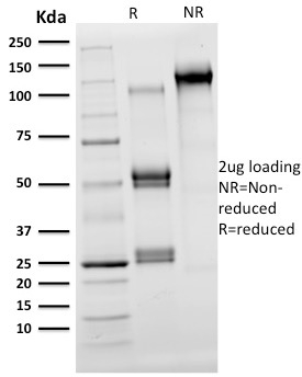 Anti-OLIG2 Antibody [OLIG2/2400] - BSA and Azide free