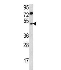 ABHD2 antibody western blot analysis in human 293 lysate. Predicted molecular weight ~48 kDa