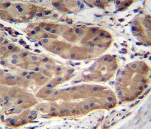 ABHD2 antibody immunohistochemistry analysis in formalin fixed and paraffin embedded human stomach tissue.