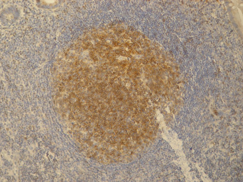 Anti-PAG1 Antibody [PAG-C1]