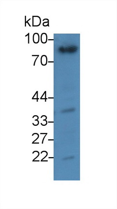 Western Blot; Sample: Human Lung lysate<br/>Primary Ab: 3µg/ml Mouse Anti-Human GSN Antibody<br/>Second Ab: 0.2µg/mL HRP-Linked Caprine Anti-Mouse IgG Polyclonal Antibody<br/>(Catalog: SAA544Mu19)