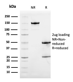 Anti-Calprotectin Antibody [S100A9/1075] - BSA and Azide free