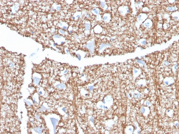 IHC staining of FFPE human brain with Myelin Basic Protein antibody (clone MBP/4273). HIER: boil tissue sections in pH 9 10mM Tris with 1mM EDTA for 20 min and allow to cool before testing.