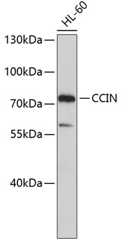 Anti-CCIN Antibody