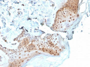 IHC staining of FFPE human skin with OGG1 antibody. HIER: boil tissue sections in pH 9 10mM Tris with 1mM EDTA for 20 min and allow to cool before testing.