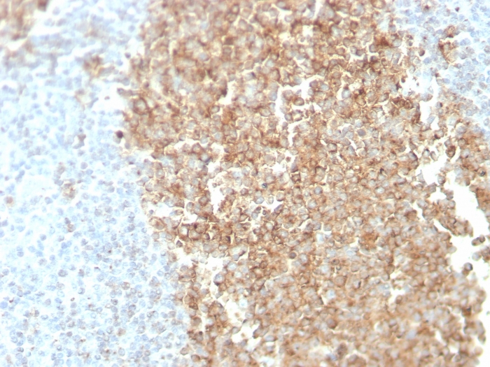 Anti-CDw75 Antibody [ZB55] - BSA and Azide free