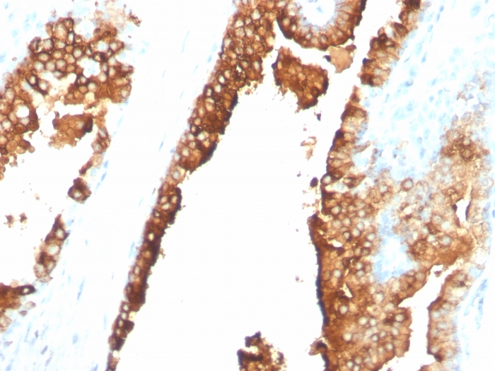 Anti-CDw75 Antibody [ZB55] - BSA and Azide free