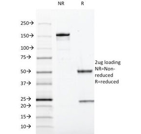 SDS-PAGE Analysis of Purified, BSA-Free SOX10 Antibody (clone SOX10/991). Confirmation of Integrity and Purity of the Antibody.