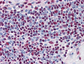 IHC testing of FFPE human spleen tissue with Ku80 antibody at 5ug/ml. Required HIER: steamed antigen retrieval with pH6 citrate buffer; AP-staining.