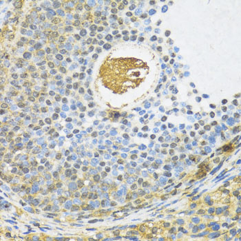 Anti-SMAD3 Antibody