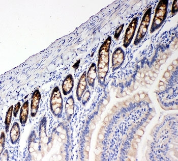 IHC-P: NKCC1 antibody testing of rat intestine tissue
